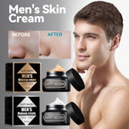 Brightening Concealer Acne Marks Skin Care Cream