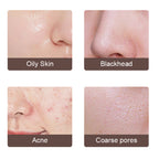 USB Electric Ultrasonic Derma Skin Scrubber
